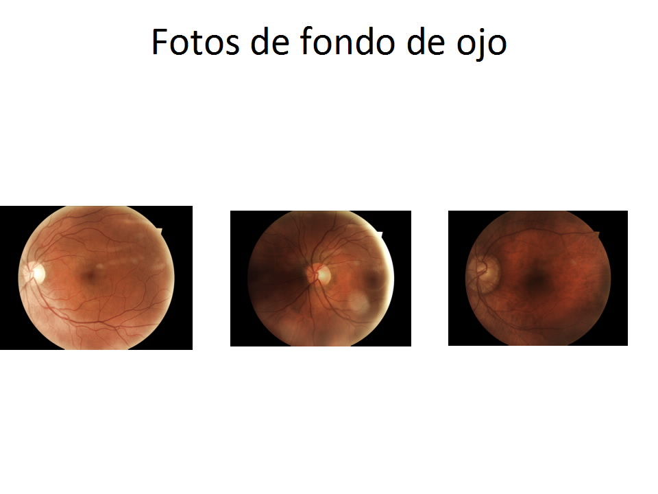 Fondo de ojos: Nuestros Servicios de Óptica Line Fondo de ojos: Nuestros Servicios de Óptica Line
