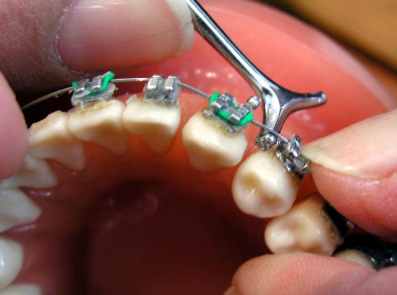 Ortodoncia: Servicios de Alser Dental Ortodoncia: Servicios de Alser Dental