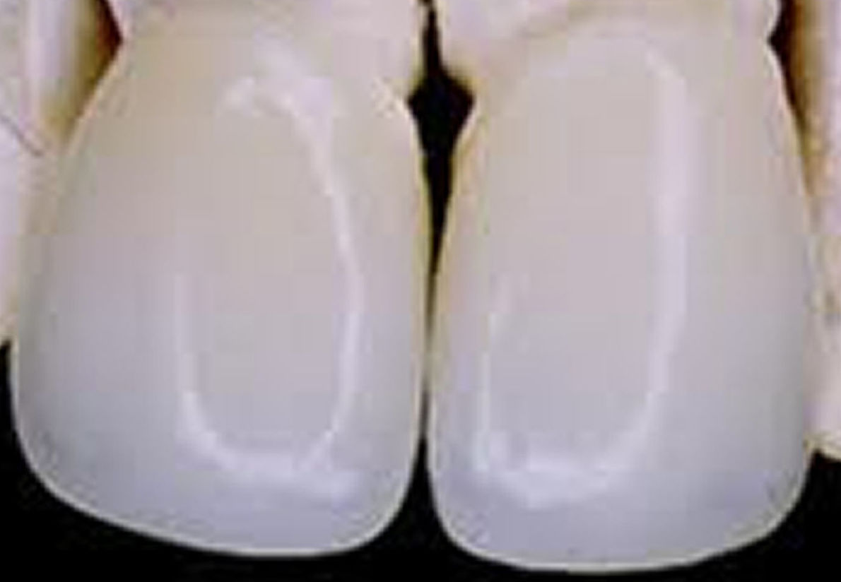 Fundas alumina Fundas alumina