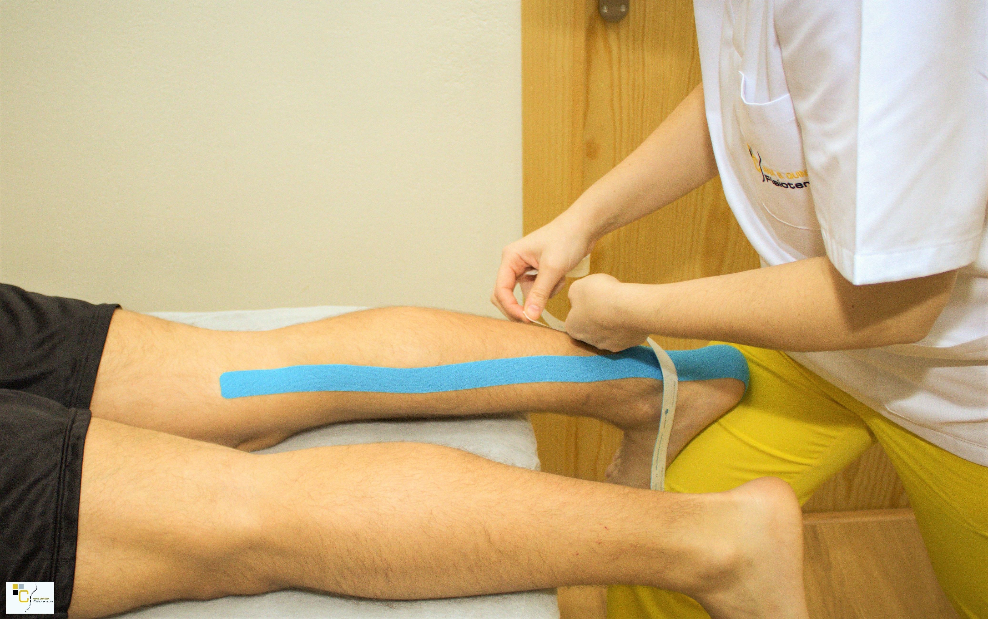 Kinesiotaping: Tratamientos de Clínica Fisioterapia Ana B. Quintana Kinesiotaping: Tratamientos de Clínica Fisioterapia Ana B. Quintana