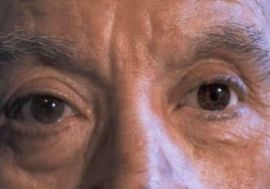 Prótesis oculares: ¿Qué hacemos? de Centro Visión Cruces Prótesis oculares: ¿Qué hacemos? de Centro Visión Cruces