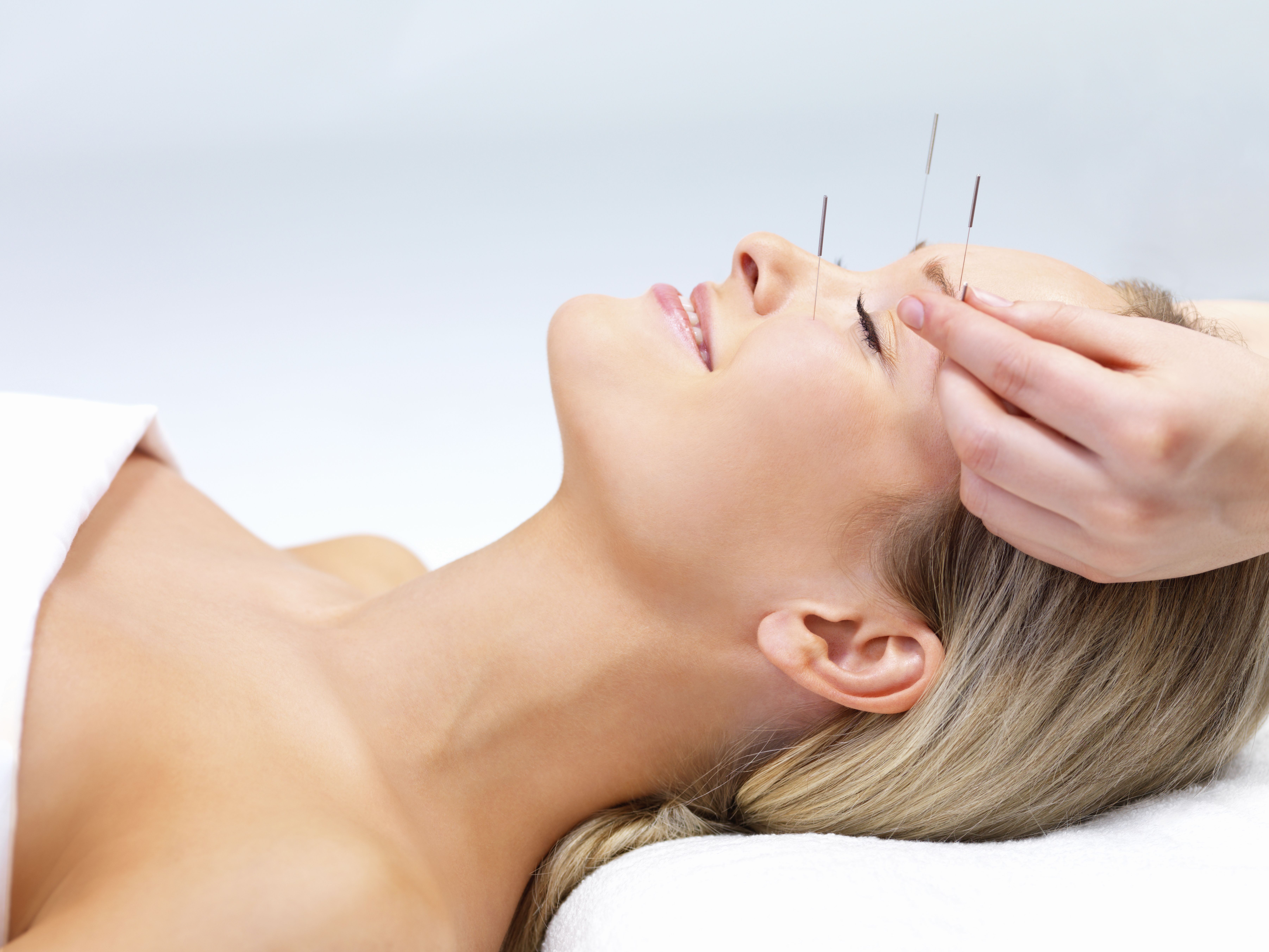 Acupuntura: Servicios de Valkirias Belleza y Bienestar Acupuntura: Servicios de Valkirias Belleza y Bienestar