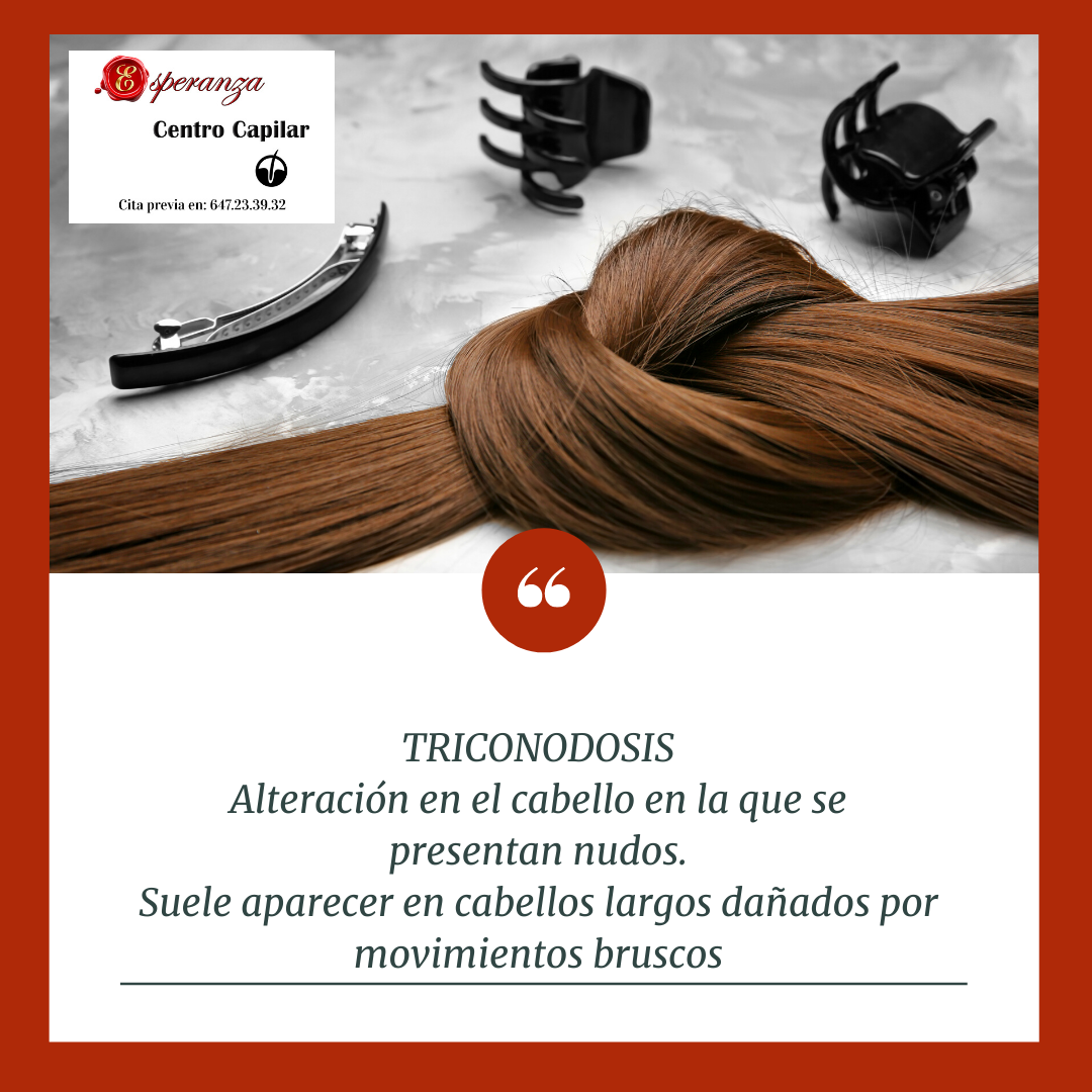 Tratamientos Capilares: Servicios de Esperanza Centro Capilar Tratamientos Capilares: Servicios de Esperanza Centro Capilar