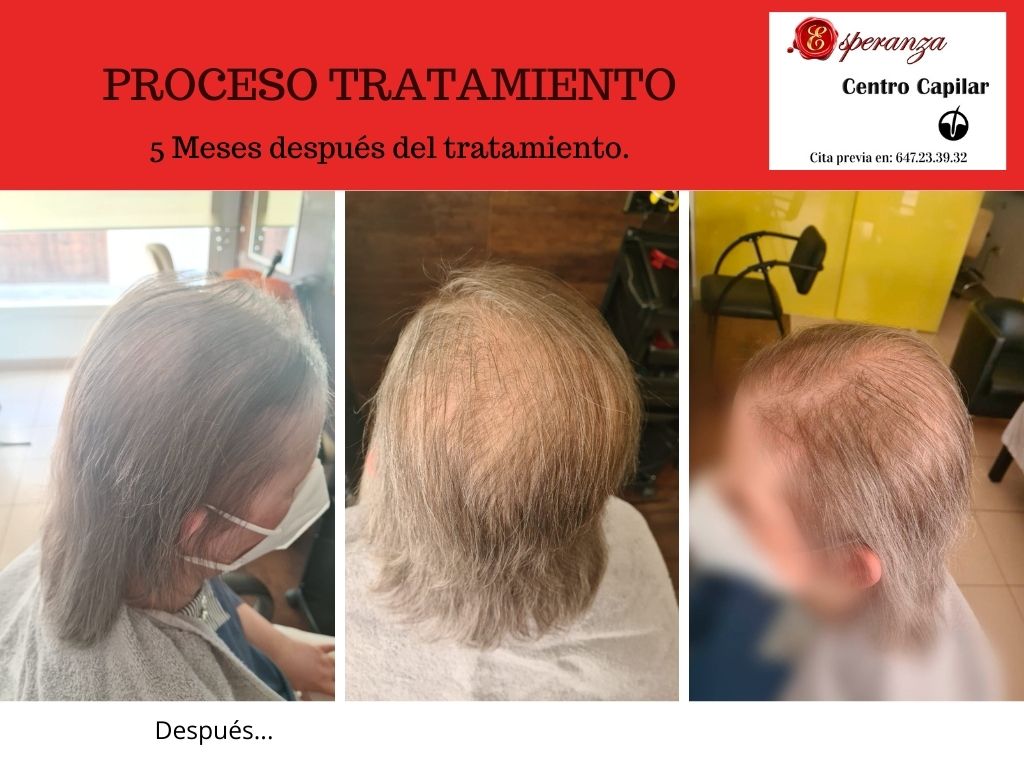 Tratamientos Capilares: Servicios de Esperanza Centro Capilar Tratamientos Capilares: Servicios de Esperanza Centro Capilar