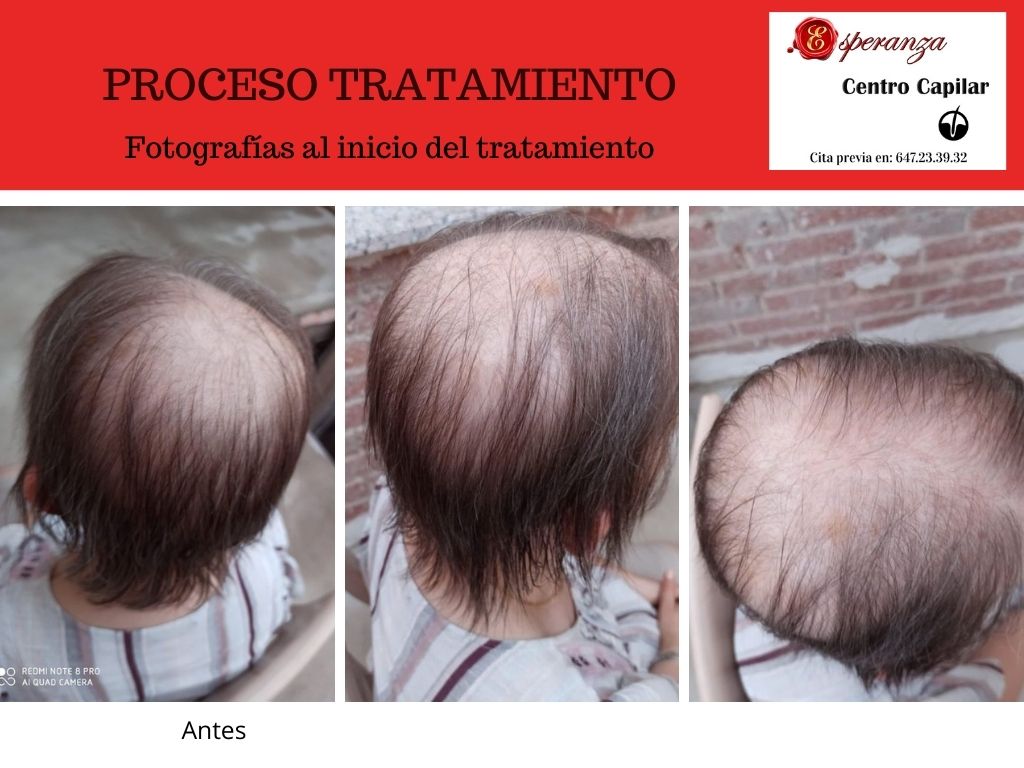 Tratamientos Capilares: Servicios de Esperanza Centro Capilar Tratamientos Capilares: Servicios de Esperanza Centro Capilar