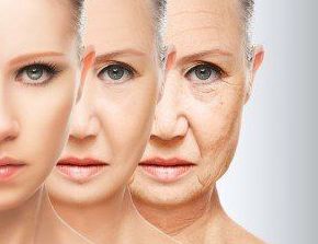 HILOS TENSORES: Tratamientos de Centro de belleza y medicina estética Lucy Lara HILOS TENSORES: Tratamientos de Centro de belleza y medicina estética Lucy Lara