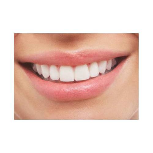 Estética dental: Especialidades de Estil Dental Estética dental: Especialidades de Estil Dental