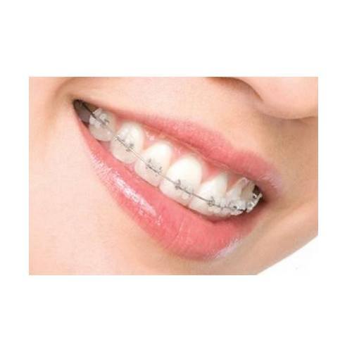 Ortodoncia: Especialidades de Estil Dental Ortodoncia: Especialidades de Estil Dental