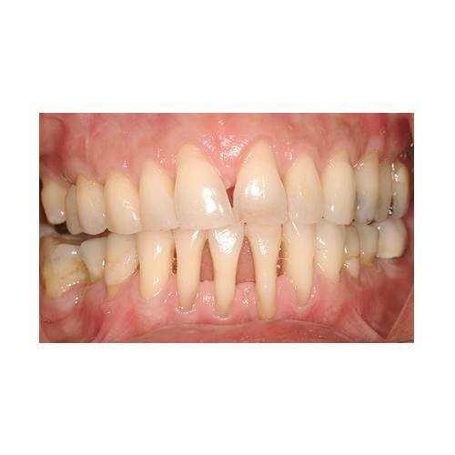 Periodoncia: Especialidades de Estil Dental Periodoncia: Especialidades de Estil Dental