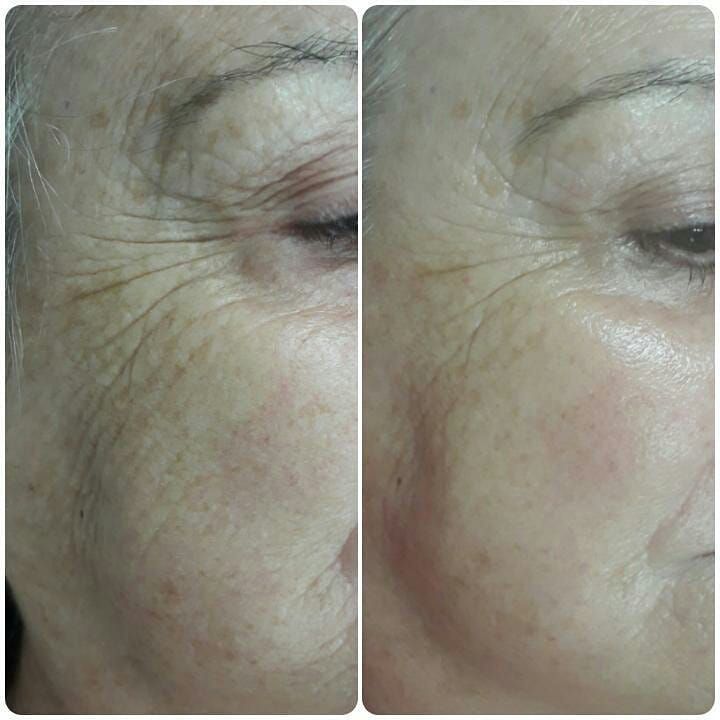 Micropigmentación: Tratamientos de Salvia Belleza y Salud Micropigmentación: Tratamientos de Salvia Belleza y Salud
