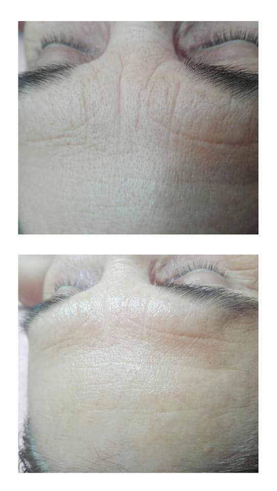 Micropigmentación: Tratamientos de Salvia Belleza y Salud Micropigmentación: Tratamientos de Salvia Belleza y Salud