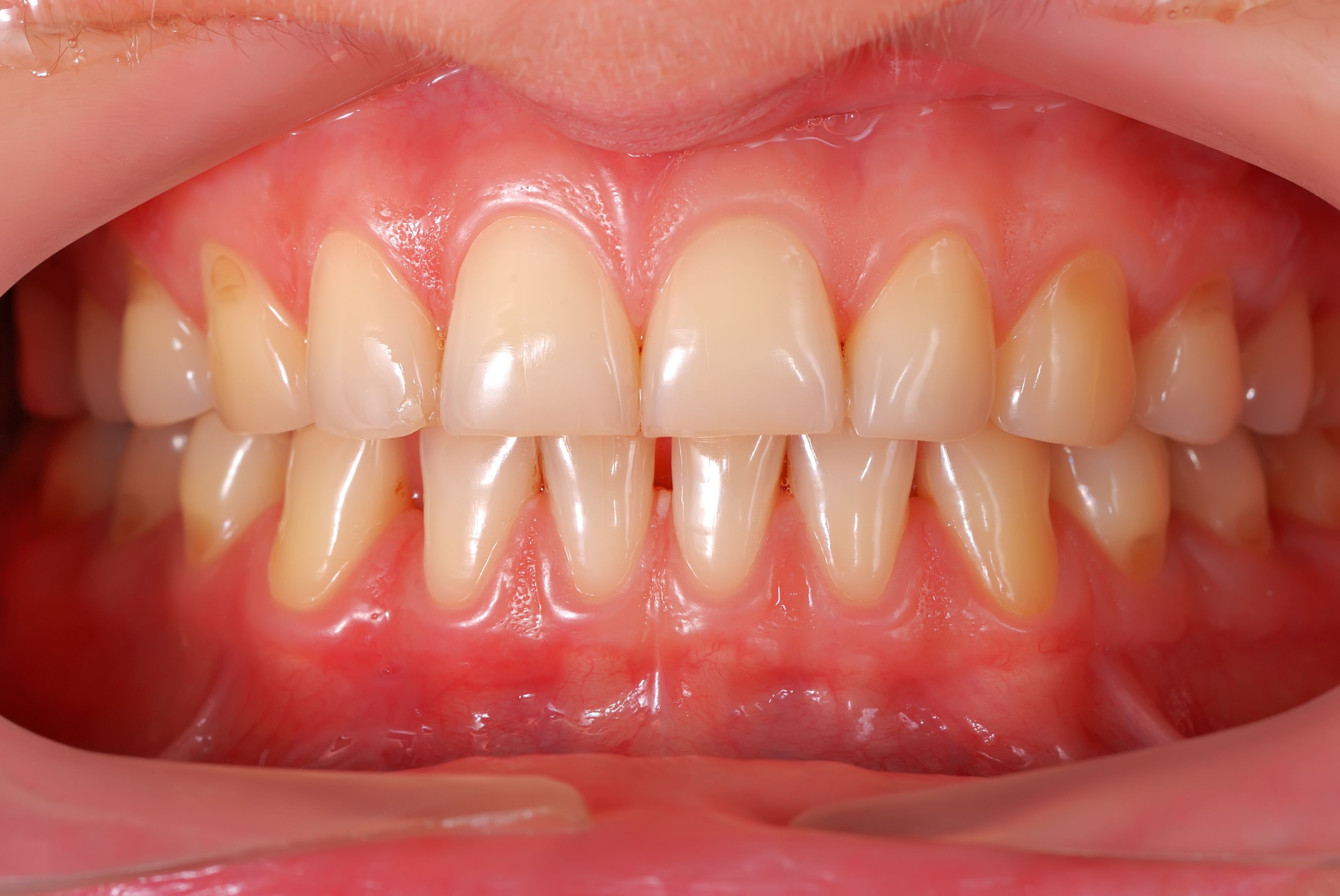 Cirugía: Tratamientos de Gavà Mar Dental Cirugía: Tratamientos de Gavà Mar Dental