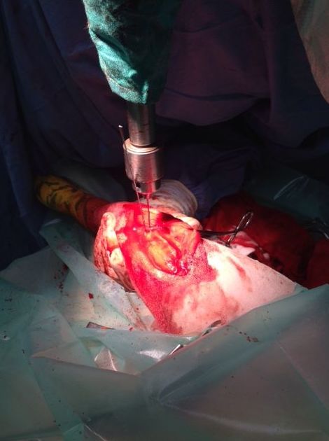 Traumatología Traumatología