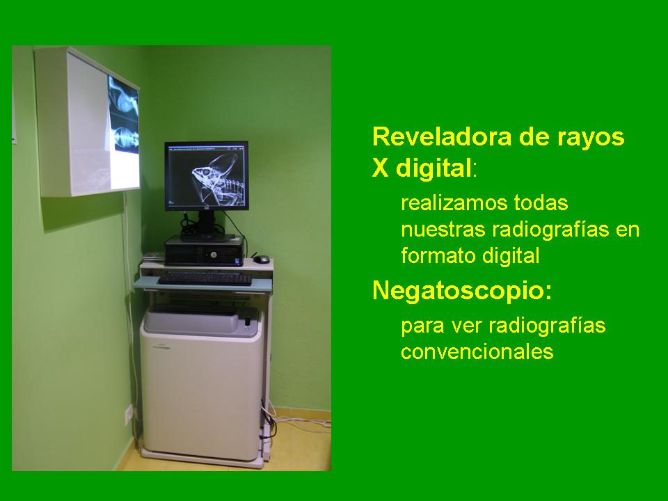 Reveladora de Rayos X digital. Negatoscopio. 