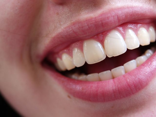 Estética dental Estética dental