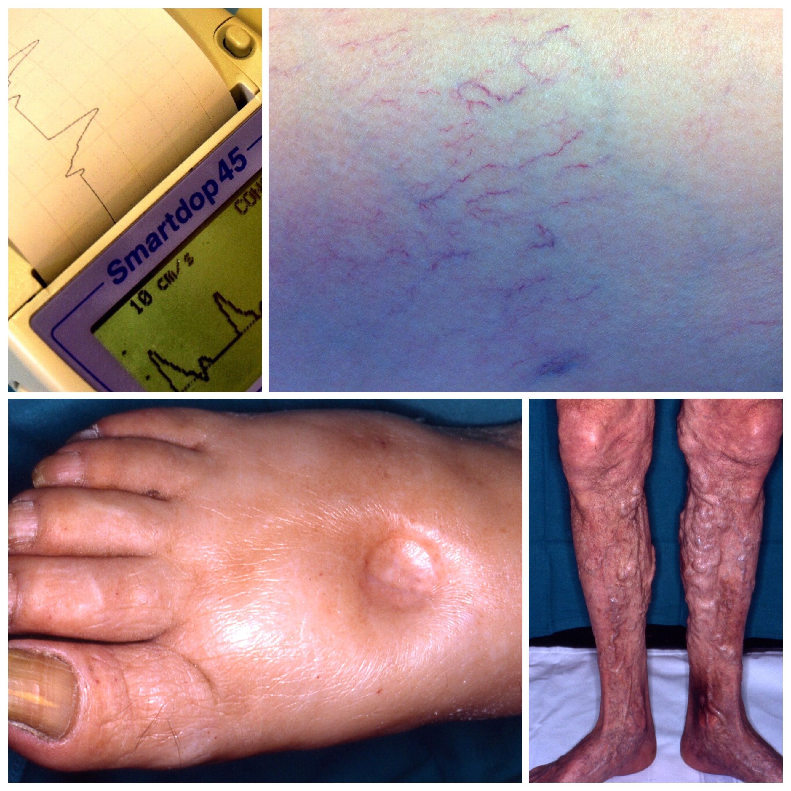 Nuestros tratamientos: Productos y servicios de Consulta Barreiro-Vascular (Dr. A. Barreiro Mouro) Nuestros tratamientos: Productos y servicios de Consulta Barreiro-Vascular (Dr. A. Barreiro Mouro)