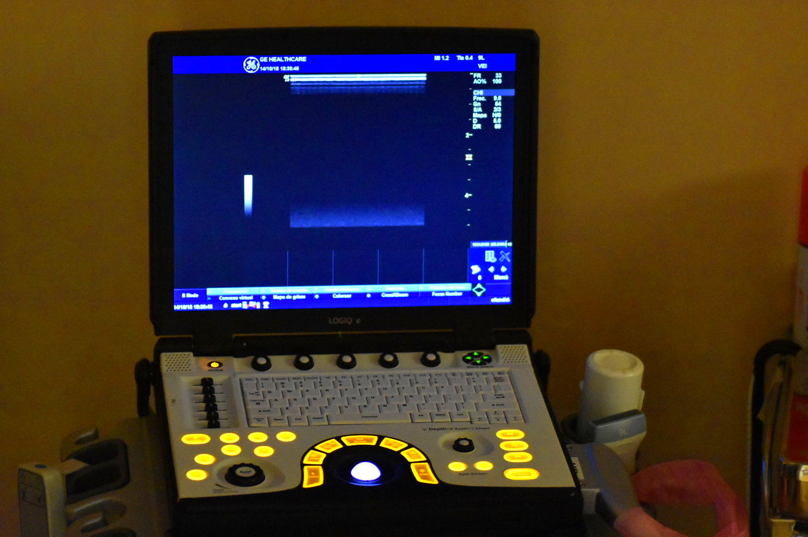 Eco-Doppler GE LOGIQ e Eco-Doppler GE LOGIQ e
