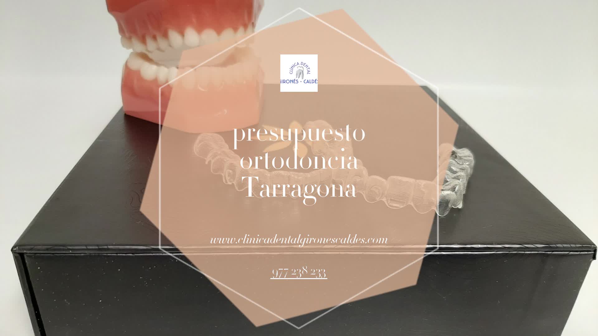 Presupuesto para ortodoncia en Tarragona Clínica Dental Gironés Caldés Presupuesto para ortodoncia en Tarragona Clínica Dental Gironés Caldés