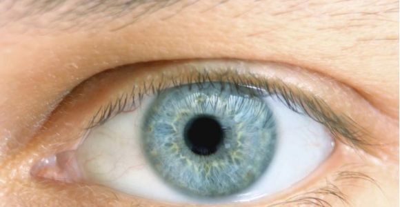 Operación de glaucoma en Asturias