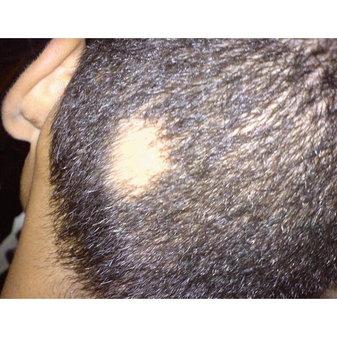 Dermatología Adultos : Especialidades de Reyes Ramírez, A. Dermatología Adultos : Especialidades de Reyes Ramírez, A.