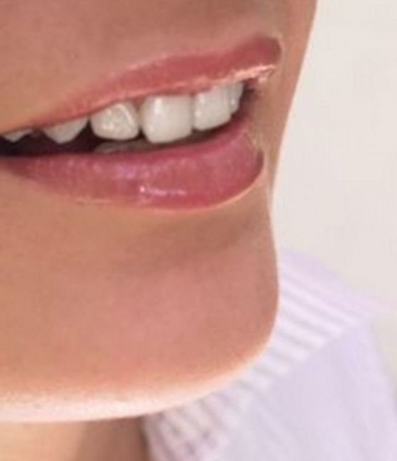 Estética dental: Tratamientos de Vitaldent Estética dental: Tratamientos de Vitaldent