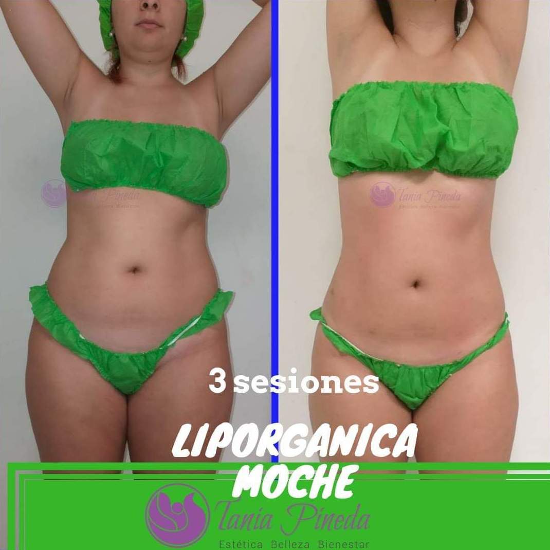 Liporgánica Moche: Tratamientos de Estética Tania Pineda Liporgánica Moche: Tratamientos de Estética Tania Pineda