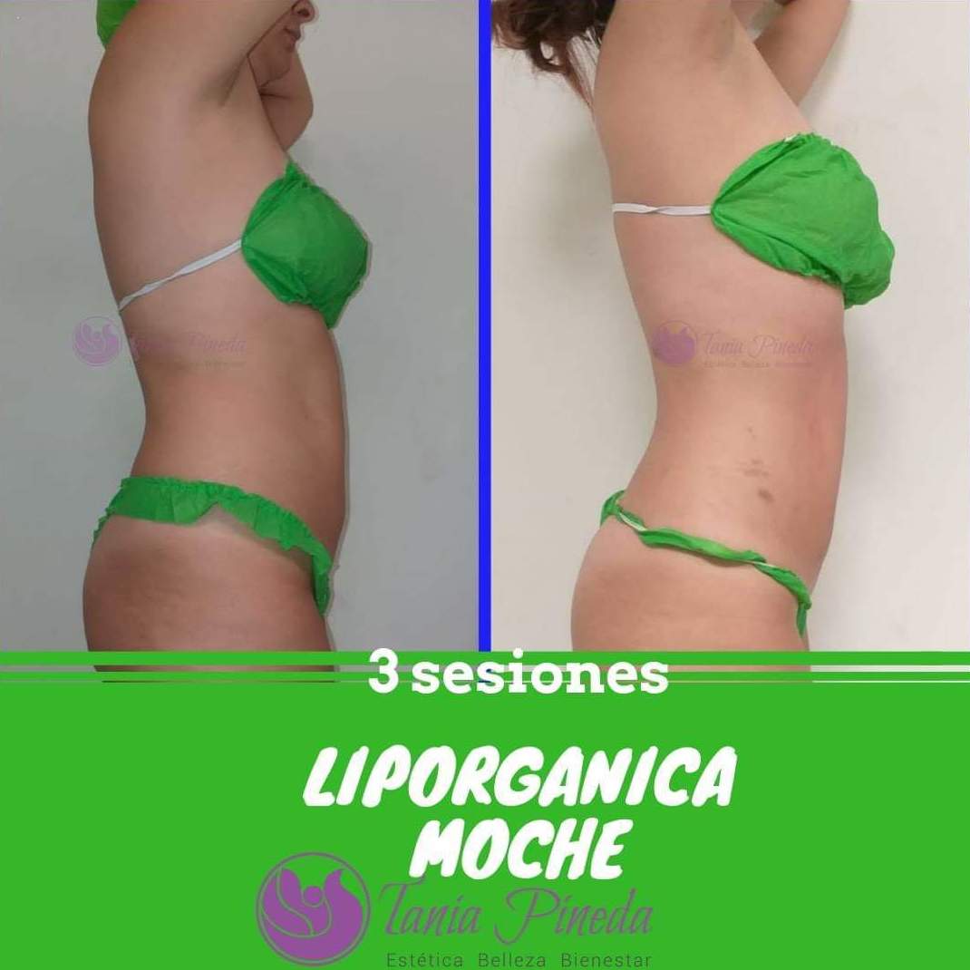 Liporgánica Moche: Tratamientos de Estética Tania Pineda Liporgánica Moche: Tratamientos de Estética Tania Pineda