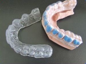 Otros tipos de prótesis: Servicios de Ángel Dueñas Laboratorio Dental Otros tipos de prótesis: Servicios de Ángel Dueñas Laboratorio Dental
