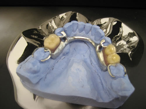 Foto 2 de Protésicos dentales en Madrid | Ángel Dueñas Laboratorio Dental