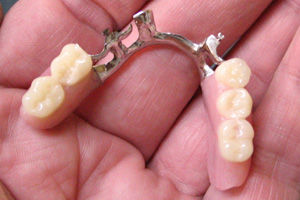 Foto 13 de Protésicos dentales en Madrid | Ángel Dueñas Laboratorio Dental