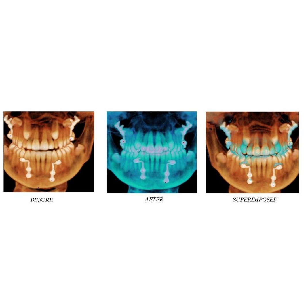 Implantes dentales: Servicios de Clínica Dental Gándara