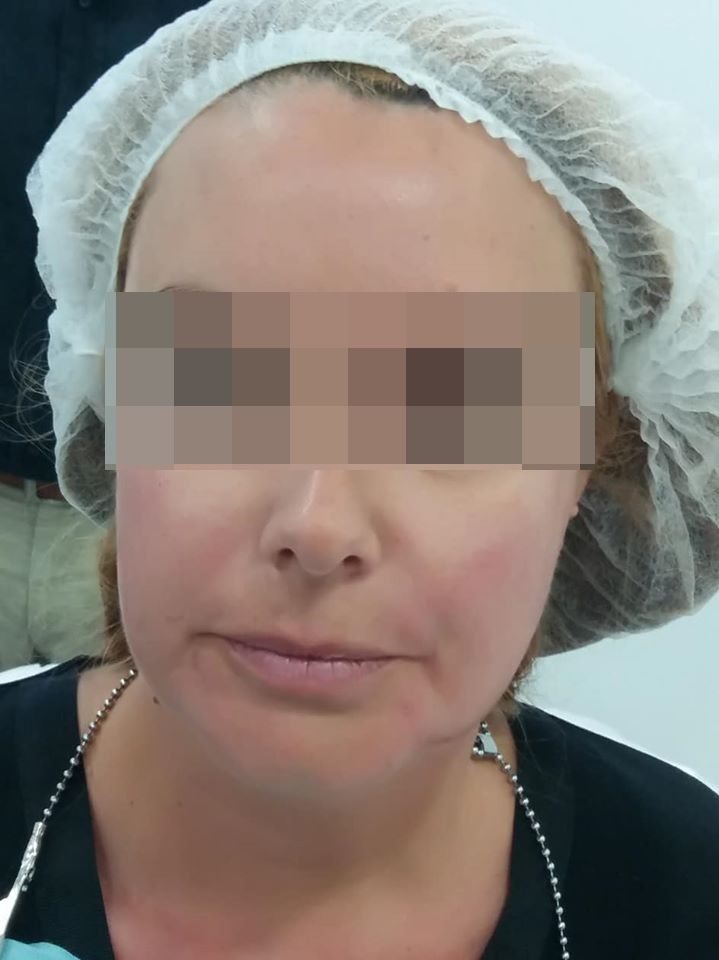 Toxina botulínica (bótox): Nuestros tratamientos de Clínica Doctor Pérez de León Toxina botulínica (bótox): Nuestros tratamientos de Clínica Doctor Pérez de León