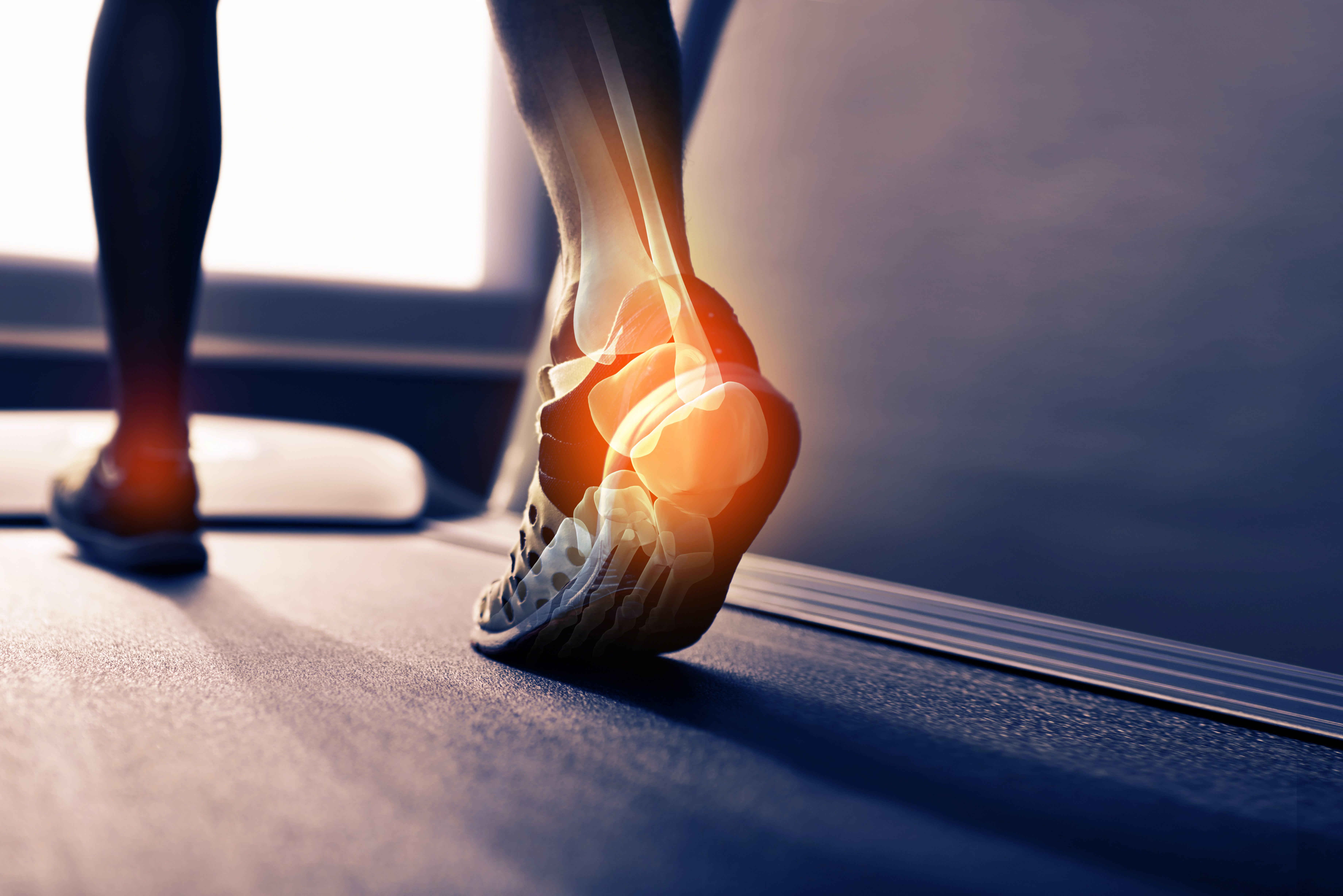 Biomecánica: Especialidades de Clínica Podológica Bertendona Biomecánica: Especialidades de Clínica Podológica Bertendona
