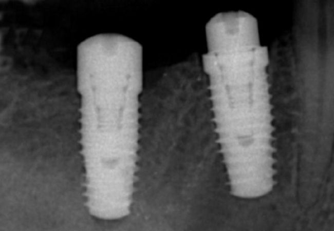 Radiografías: Tratamientos de Clínica Dental Paupie Radiografías: Tratamientos de Clínica Dental Paupie