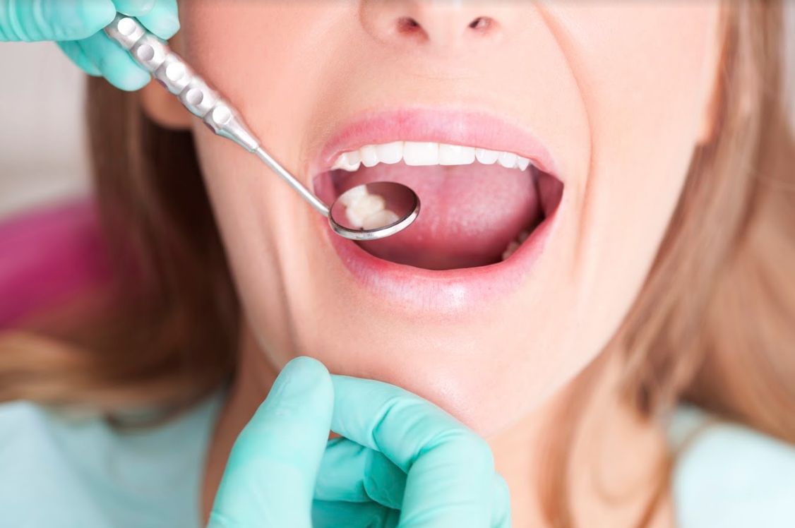 Técnicas implantológicas: Servicios especializados de Centro Estético Dental García Marí Tenerife Técnicas implantológicas: Servicios especializados de Centro Estético Dental García Marí Tenerife