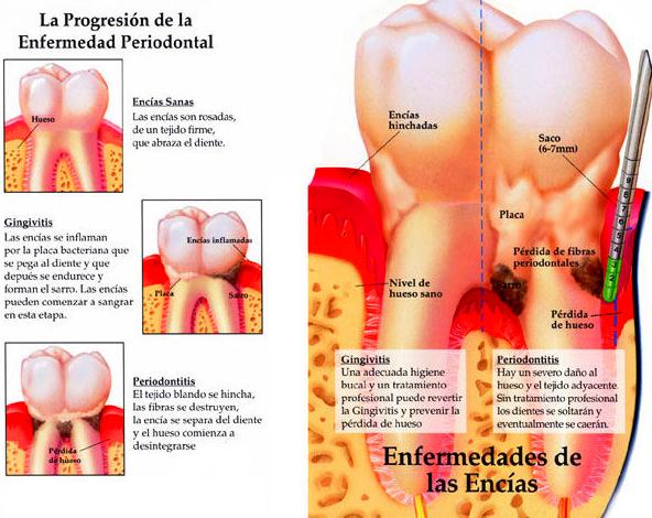 Periodoncia: Tratamientos de Maite Pérez Corrales Periodoncia: Tratamientos de Maite Pérez Corrales