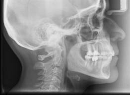 Radiología: Tratamientos de Maite Pérez Corrales Radiología: Tratamientos de Maite Pérez Corrales