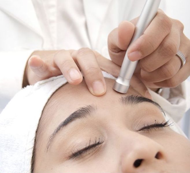 Microdermoabrasión con punta de diamante: Servicios de Anel Estética Microdermoabrasión con punta de diamante: Servicios de Anel Estética