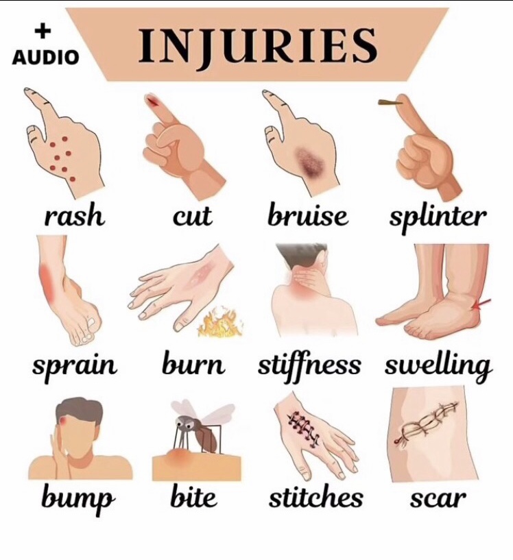 Injuries