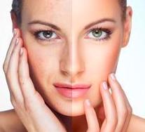 Tratamiento Carboxyterapia facial: Servicios de Centro de estética integral y bienestar Mundo de Ensueño Tratamiento Carboxyterapia facial: Servicios de Centro de estética integral y bienestar Mundo de Ensueño