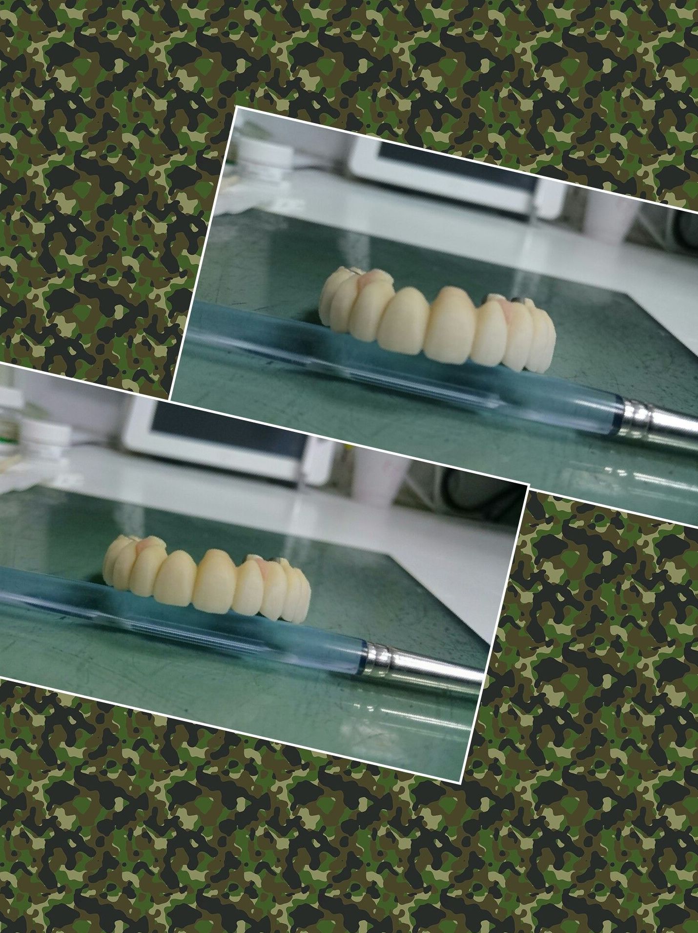 Implantes: Nuestros servicios de Clínica Dental Balbarán Implantes: Nuestros servicios de Clínica Dental Balbarán