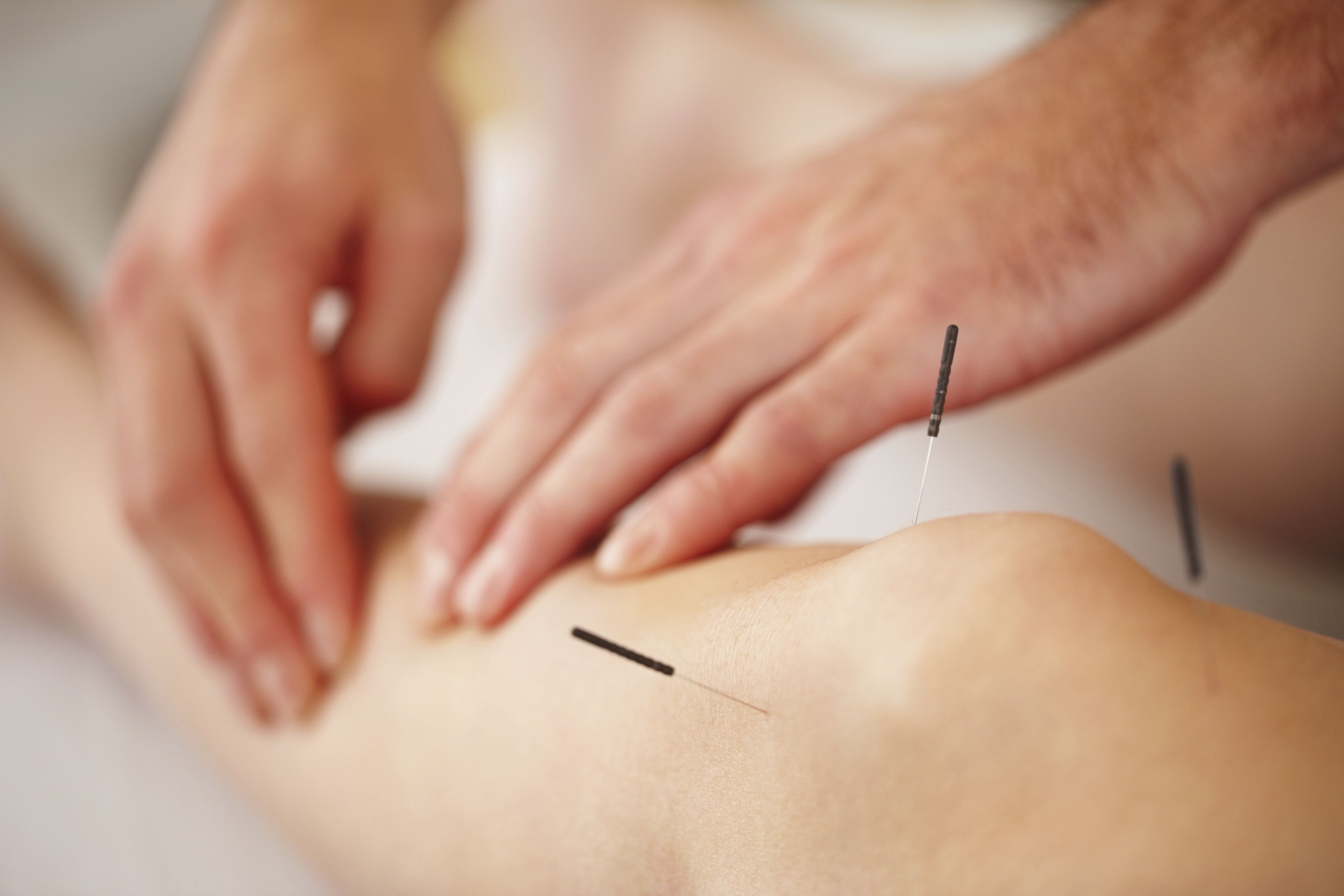 Acupuntura: Servicios de Alqiro Acupuntura: Servicios de Alqiro