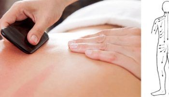 Gua-Sha: Servicios de Terapies Naturals BIB Gua-Sha: Servicios de Terapies Naturals BIB