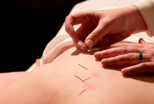 Terapias alternativas y acupuntura en Martorell