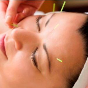Acupuntura facial + meso + air brush: Servicios de Terapies Naturals BIB Acupuntura facial + meso + air brush: Servicios de Terapies Naturals BIB