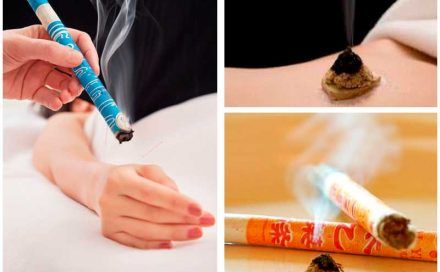 Moxibustion: Servicios de Terapies Naturals BIB Moxibustion: Servicios de Terapies Naturals BIB