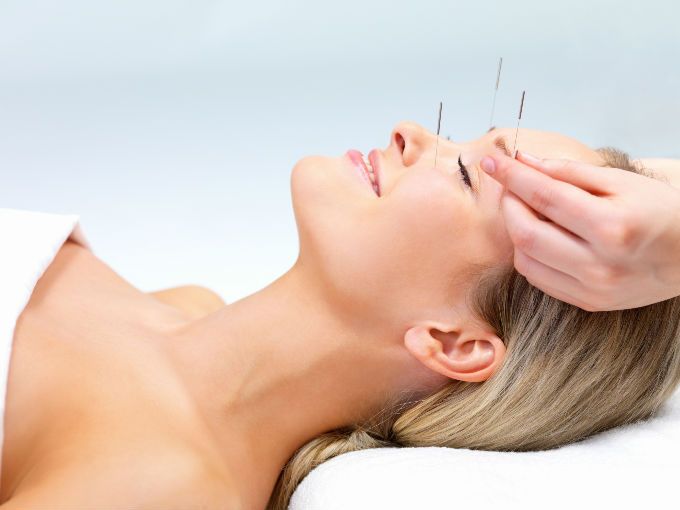 Lifting facial con acupuntura: Servicios de Terapies Naturals BIB Lifting facial con acupuntura: Servicios de Terapies Naturals BIB