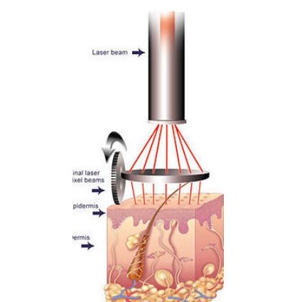 Arrugas y cicatrices: Tratamientos de Fabián Mirón Medicina Estética Arrugas y cicatrices: Tratamientos de Fabián Mirón Medicina Estética