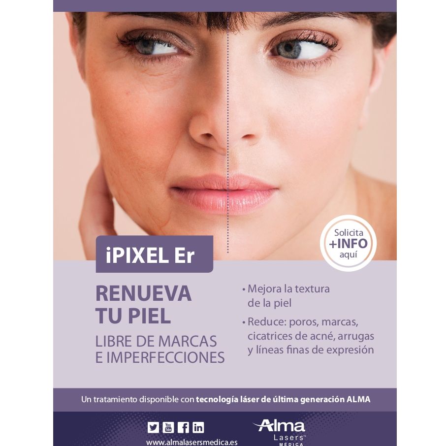 Arrugas y cicatrices: Tratamientos de Fabián Mirón Medicina Estética Arrugas y cicatrices: Tratamientos de Fabián Mirón Medicina Estética