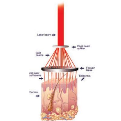 Arrugas y cicatrices: Tratamientos de Fabián Mirón Medicina Estética Arrugas y cicatrices: Tratamientos de Fabián Mirón Medicina Estética